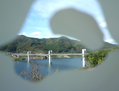 緑内障の治療もお任せください